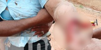 Foto: Mujer sufre graves lesiones en Wiwas/TN8