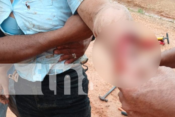 Foto: Mujer sufre graves lesiones en Wiwas/TN8 Foto: Mujer sufre graves lesiones en Wiwas/TN8