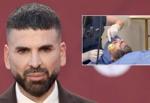 Foto: Jomari Goyso se somete a retoque estético /Cortesía