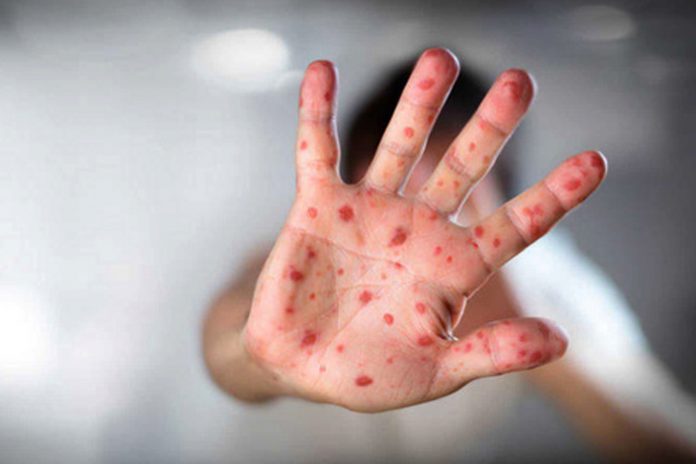 Foto: Bolivia declara emergencia sanitaria nacional /Cortesía Foto: Bolivia declara emergencia sanitaria nacional /Cortesía