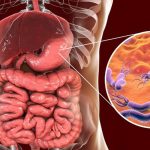 Foto: Prevención de H. pylori evitaría millones de muertes/Cortesía