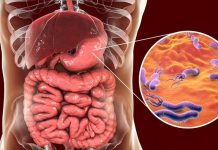 H. pylori amenaza a millones de jóvenes en el mundo Foto: Prevención de H. pylori evitaría millones de muertes/Cortesía
