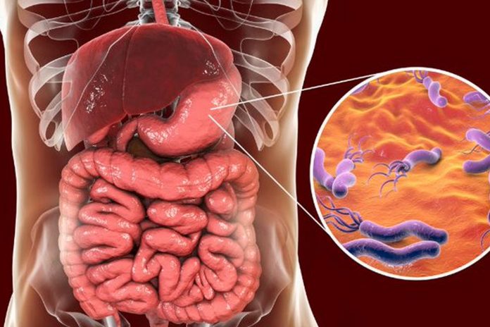 Foto: Prevención de H. pylori evitaría millones de muertes/Cortesía