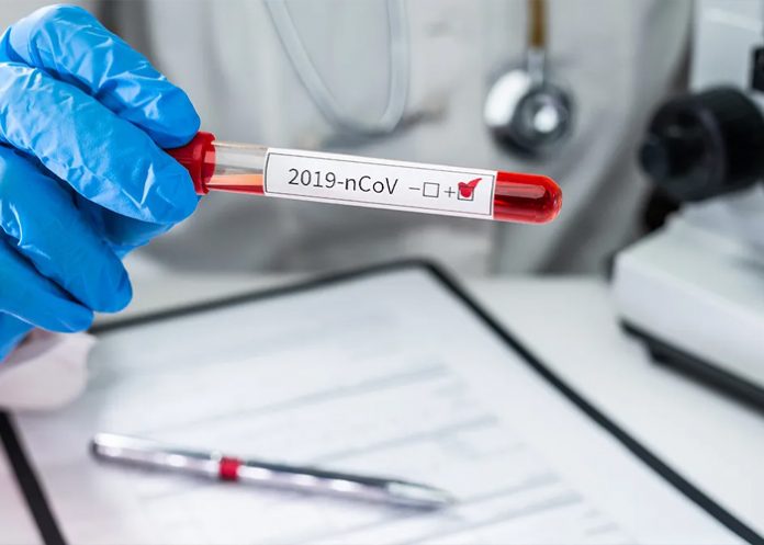 Foto: Covid-19 repunta en Honduras /cortesía