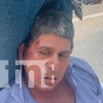 Accidente en Juigalpa deja un herido: cruzó la vía sin precaución FOTO: Juigalpa peatón ebrio es embestido por bus/TN8