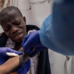 Primera muerte por Mpox en Ghana enciende las alarmas sanitarias Foto: Brote de Mpox en Ghana /cortesía