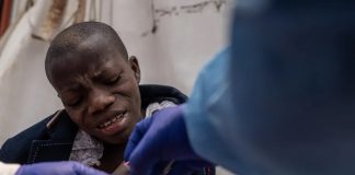 Foto: Brote de Mpox en Ghana /cortesía