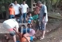 Motociclista en estado de ebriedad termina grave tras accidente en Ometepe Foto: Motociclista en estado de ebriedad termina grave tras accidente en Ometepe/TN8