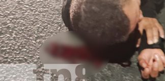 Foto: Un atropellado y un lesionado, son los resultados de dos accidentes en Managua/TN8