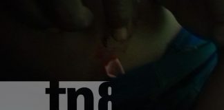 Foto: ¡Brutal ataque! Balean a niño de 11 años en la comunidad de Santa Clara, Waspam/TN8