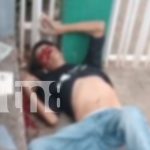Supuesto bebedor sale del hospital para perder la vida en la vía pública de Managua Foto: Managua policía investiga perdida de vida misteriosa/TN8