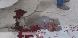 Foto: Atacan a joven con cuchillo en un barrio de Estelí / TN8