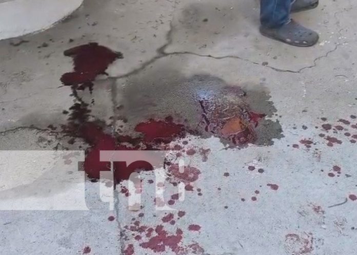 Foto: Atacan a joven con cuchillo en un barrio de Estelí / TN8 Foto: Atacan a joven con cuchillo en un barrio de Estelí / TN8