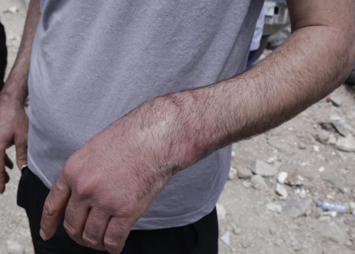 Foto: Israel intensifica ofensiva en Cisjordania /cortesía