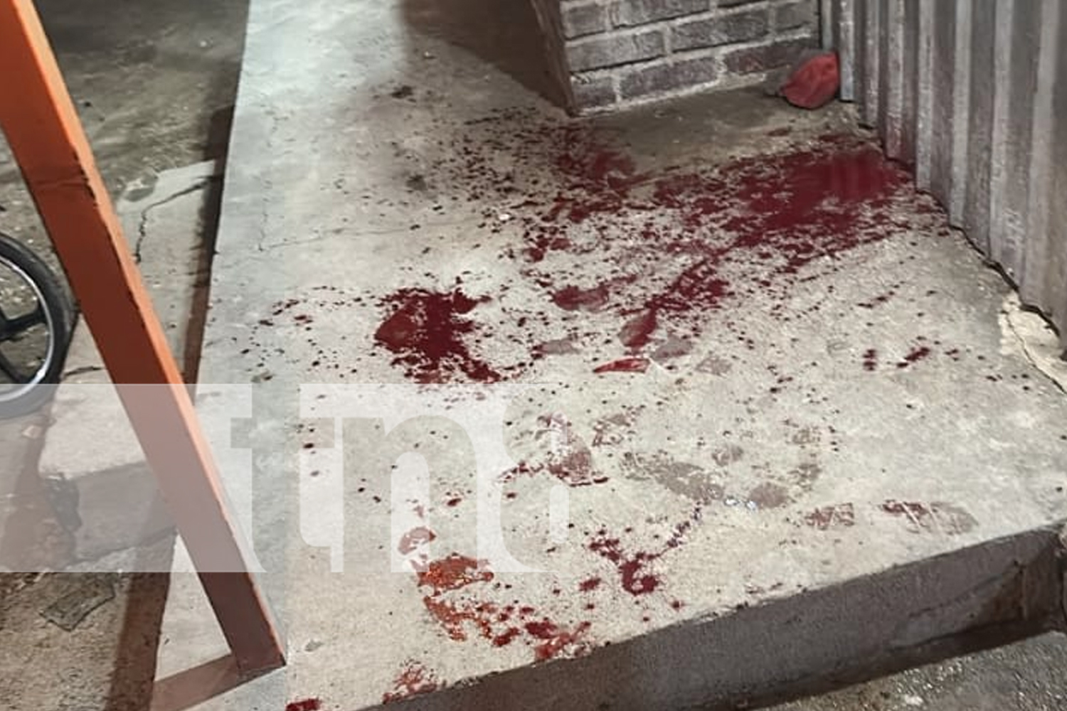 Foto: Hombre resultó con graves lesiones por arma blanca en una trifulca en Somoto, Madriz/TN8