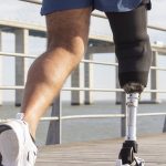 Trabajando por la salud: Especialistas de la India colocarán 500 prótesis en Nicaragua Foto: Trabajando por la salud: Especialistas de la India colocarán 500 prótesis en Nicaragua /cORTESÍA