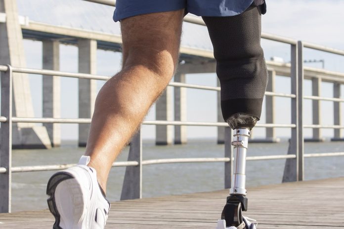 Foto: Trabajando por la salud: Especialistas de la India colocarán 500 prótesis en Nicaragua /cORTESÍA