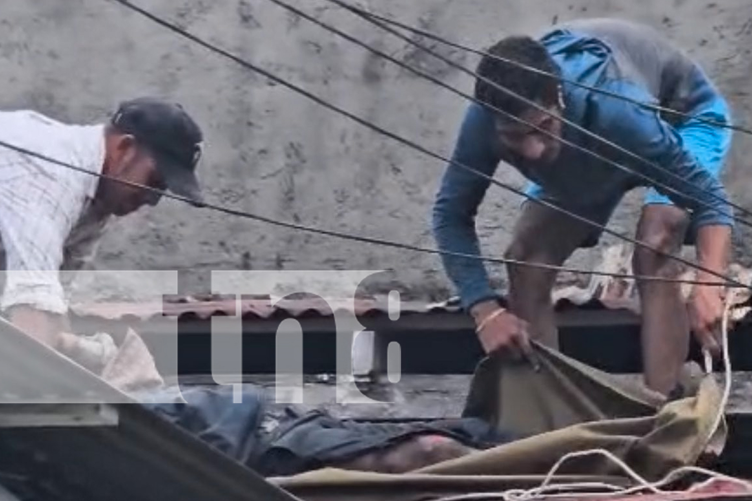 Foto: Chontales: hombre resulta con quemaduras de segundo y tercer grado/TN8