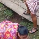 Niña con la pierna casi cercenada: Horrendo accidente en El Cuá, Jinotega Foto: Niña con la pierna casi cercenada tras accidente con bus en San José de Bocay, Jinotega / TN8