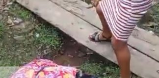 Foto: Niña con la pierna casi cercenada tras accidente con bus en San José de Bocay, Jinotega / TN8