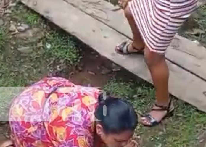 Foto: Niña con la pierna casi cercenada tras accidente con bus en San José de Bocay, Jinotega / TN8 Foto: Niña con la pierna casi cercenada tras accidente con bus en San José de Bocay, Jinotega / TN8