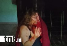 Mujer sobrevive de milagro tras recibir siete puñaladas de su pareja en Jinotepe Foto: Mujer sobrevive de milagro tras recibir siete puñaladas de su pareja en Jinotepe/TN8