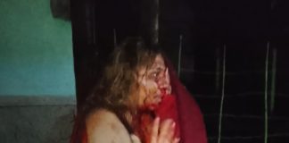 Foto: Mujer sobrevive de milagro tras recibir siete puñaladas de su pareja en Jinotepe/TN8