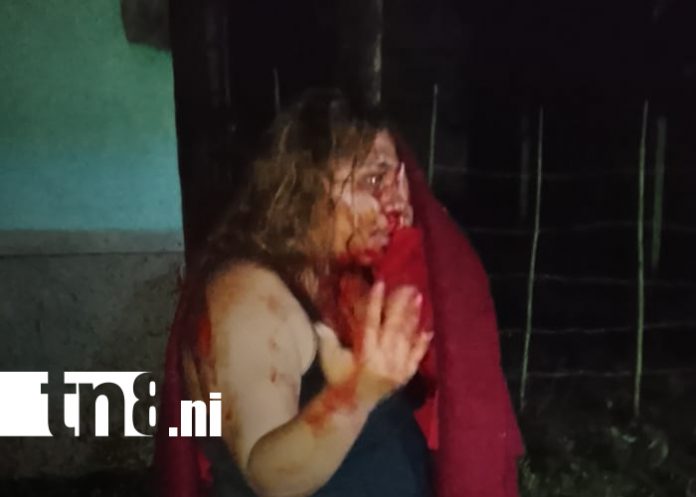 Foto: Mujer sobrevive de milagro tras recibir siete puñaladas de su pareja en Jinotepe/TN8 Foto: Mujer sobrevive de milagro tras recibir siete puñaladas de su pareja en Jinotepe/TN8