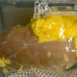 Científicos desarrollan riñón universal compatible con cualquier paciente riñón