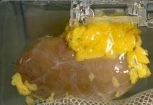 Científicos desarrollan riñón universal compatible con cualquier paciente riñón