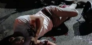 Foto: Motociclista herido tras brutal choque en Waspam Sur/TN8