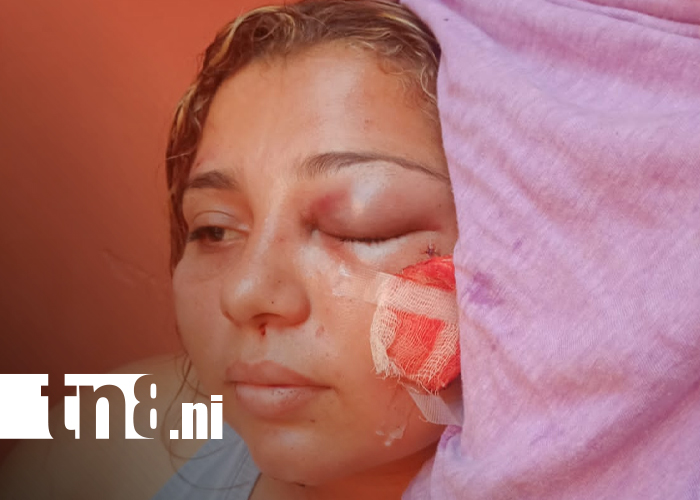 Foto: Mujer sobrevive de milagro tras recibir siete puñaladas de su pareja en Jinotepe/TN8