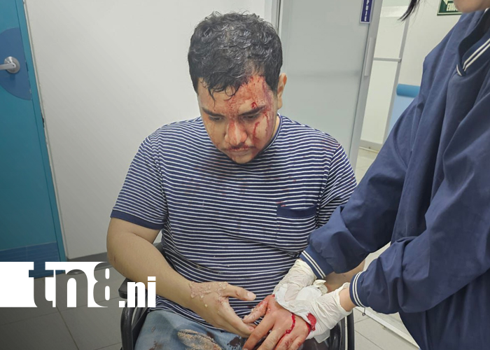 Foto: Joven sobrevive a brutal ataque en Chichigalpa, Chinandega/TN8