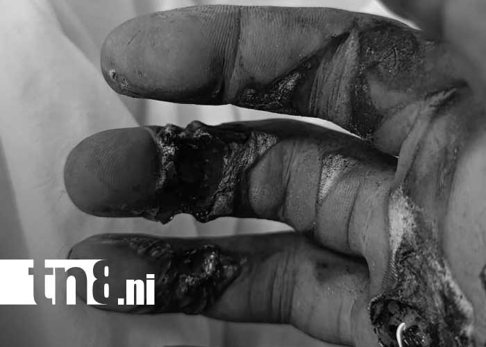 Foto: Electricidad en el hogar, un tema a manejar en cada vivienda de Nicaragua / TN8