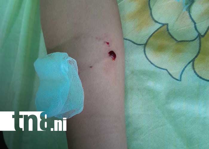 Foto: Pitbull suelto ataca a niña en San Jorge, Rivas / TN8