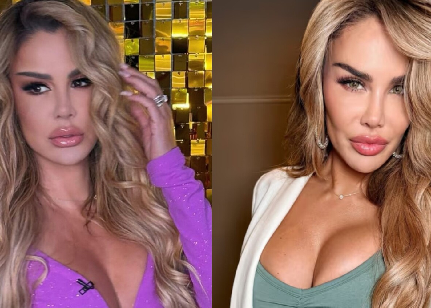 Foto: Ninel Conde se somete a cirugía para cambiar el color de sus ojos /Cortesía