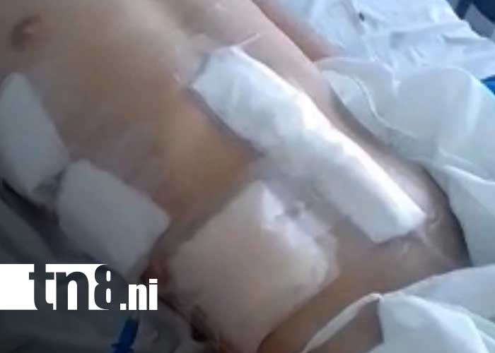 Foto: Ataque con arma blanca a joven de Solonlí, Jalapa / TN8