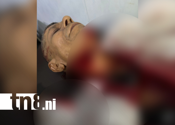 Foto: Brutal ataque en Río Blanco: adulto mayor es herido por ladrones en su lugar de trabajo/TN8