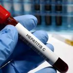 Rusia presenta la primera prueba ultrarrápida para identificar casos de hepatitis C Foto: Rusia presenta la primera prueba ultrarrápida para identificar casos de hepatitis C /Cortesía