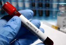 Rusia presenta la primera prueba ultrarrápida para identificar casos de hepatitis C Foto: Rusia presenta la primera prueba ultrarrápida para identificar casos de hepatitis C /Cortesía