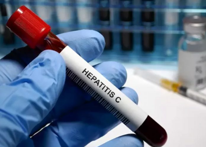 Foto: Rusia presenta la primera prueba ultrarrápida para identificar casos de hepatitis C /Cortesía Foto: Rusia presenta la primera prueba ultrarrápida para identificar casos de hepatitis C /Cortesía