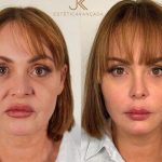 Foto: Gaby Spanic sorprende con su nuevo rostro /Cortesía
