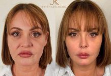 Foto: Gaby Spanic sorprende con su nuevo rostro /Cortesía