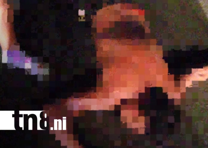 Foto: Peatón queda gravemente herido tras accidente de tránsito en Diriomo/TN8