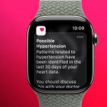 Foto: Apple Watch utiliza sensores para prevenir hipertensión/Cortesía