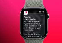 Foto: Apple Watch utiliza sensores para prevenir hipertensión/Cortesía