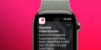 Foto: Apple Watch utiliza sensores para prevenir hipertensión/Cortesía