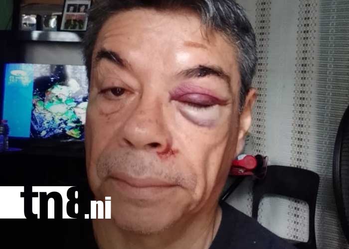 Foto: Asaltan y golpean a DJ Oscar Alvarado en Managua 
