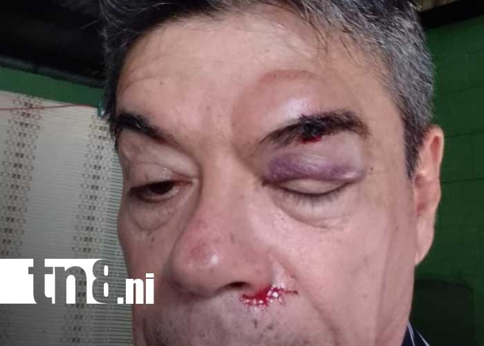 Foto: Asaltan y golpean a DJ Oscar Alvarado en Managua 