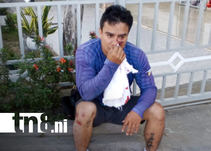 Foto: Motociclista de "Moto Mandados" termina con graves lesiones tras accidente en Rivas / TN8
